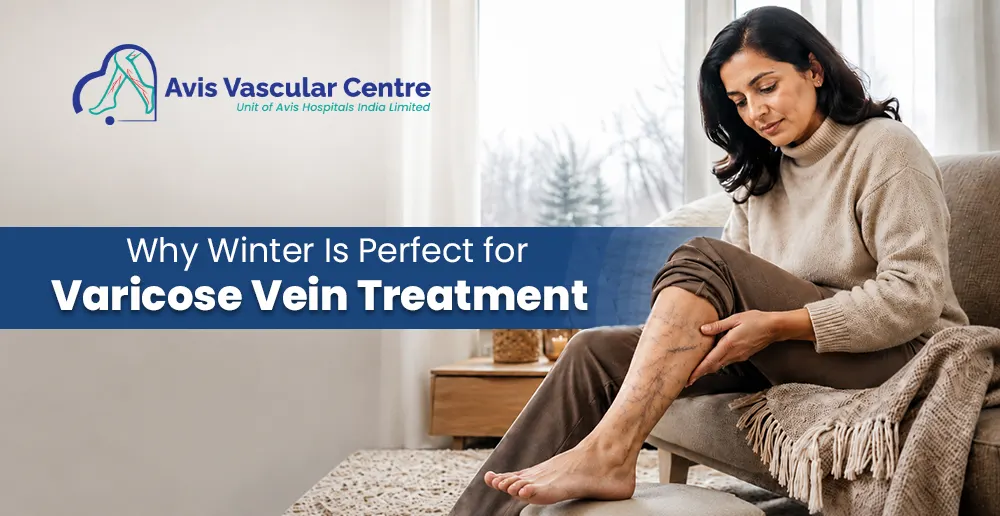 Winter-Is-Perfect-for-Varicose-Vein-Treatment