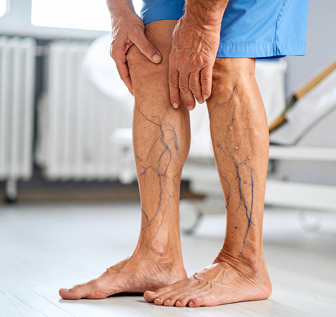 Vein Screening Image